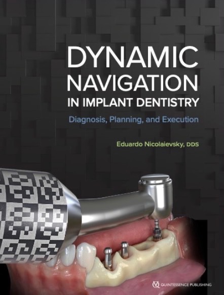 Dynamic Navigation in Implant Dentistry by Dr. Eduardo Nicolaievsky