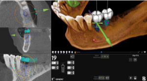 Learn More about the X-Guide Dynamic 3D Navigation System