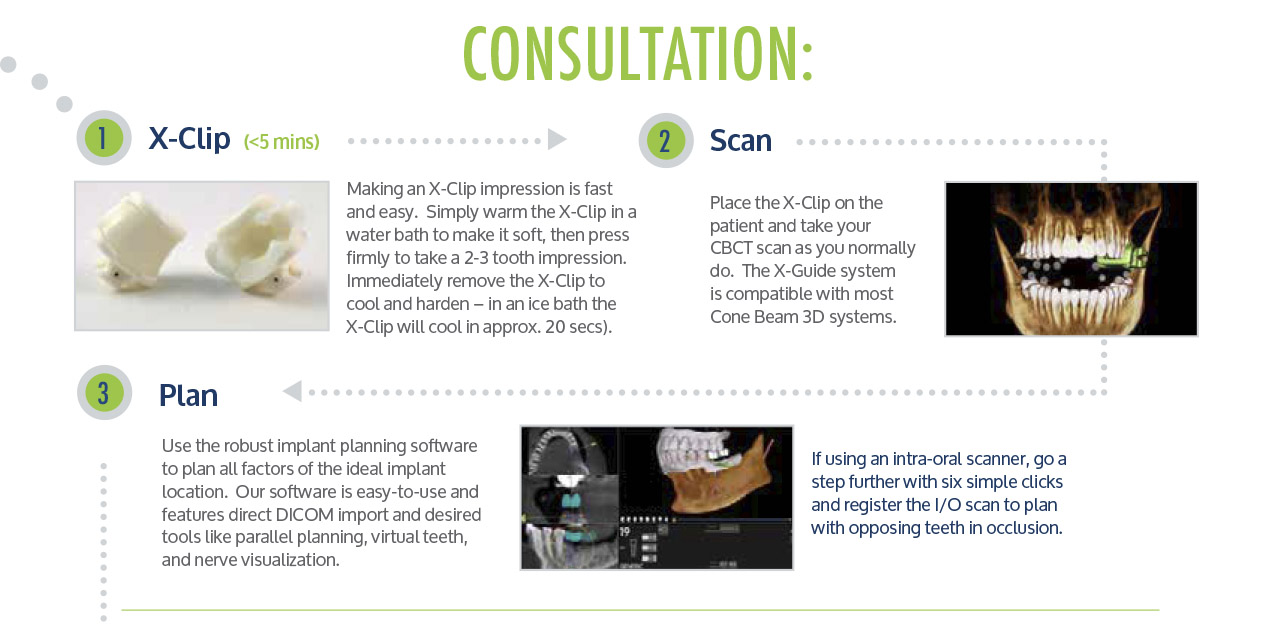 Consultation with the X-Guide