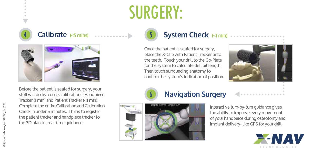 Dental Implant Surgery with the X-Guide