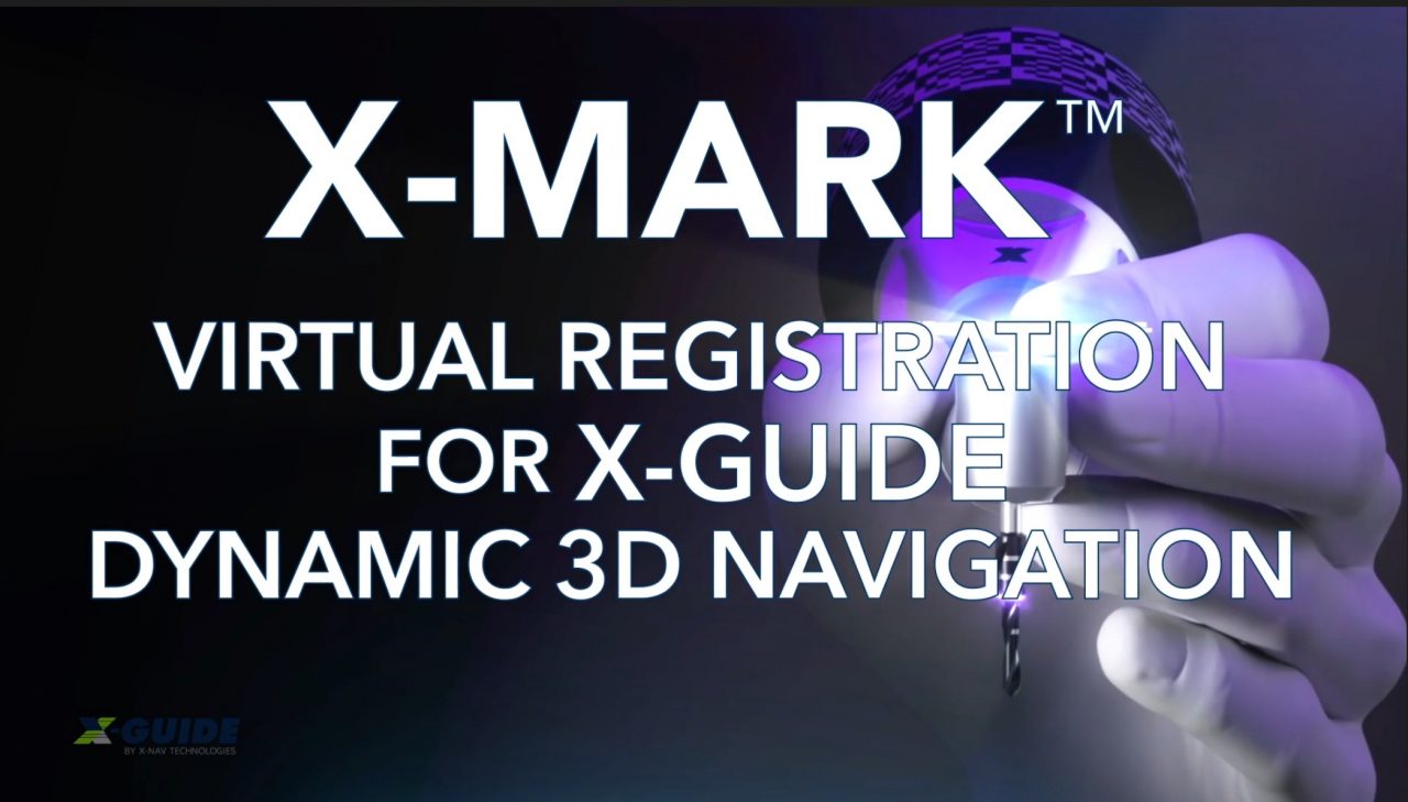 Industry News on XGuide Dynamic 3D Navigation in Dentistry