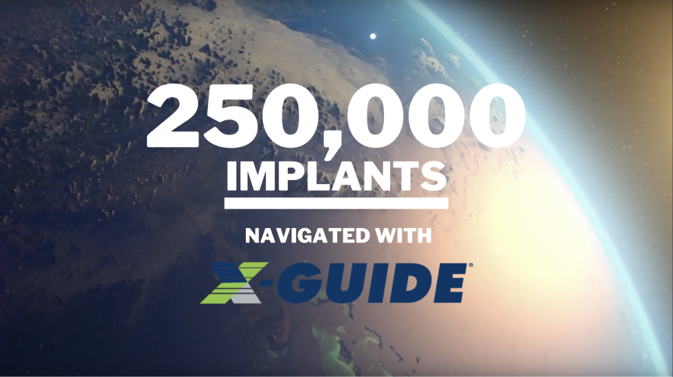 Top 10 Series of Facts You Didn't Know About XNav Technologies