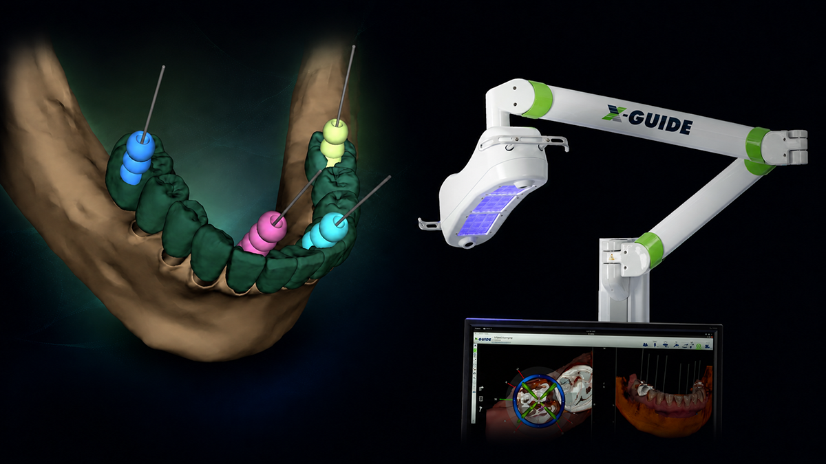 X-Nav Technologies clinical workflow