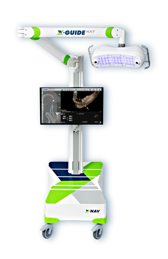 Guided surgery and digital planning